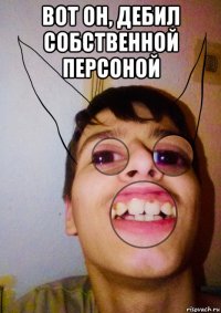 вот он, дебил собственной персоной 