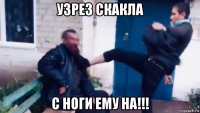 узрез скакла с ноги ему на!!!