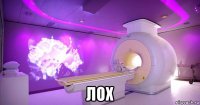  лох