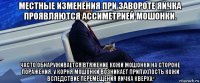 местные изменения при завороте яичка проявляются ассиметрией мошонки. часто обнаруживается втяжение кожи мошонки на стороне поражения. у корня мошонки возникает припухлость кожи вследствие перемещения яичка кверху.