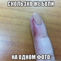 скользко же боли на одном фото