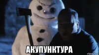  акупунктура