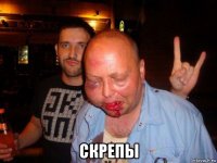  скрепы