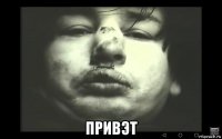  привэт