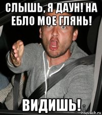 слышь, я даун! на ебло мое глянь! видишь!