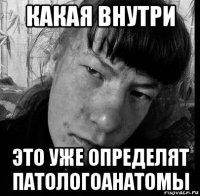какая внутри это уже определят патологоанатомы