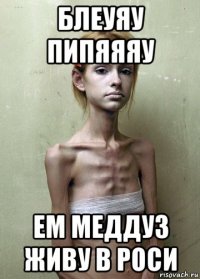 блеуяу пипяяяу ем меддуз живу в роси