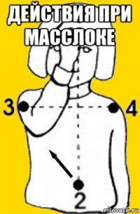 действия при масслоке 