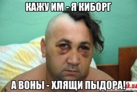 кажу им - я киборг а воны - хлящи пыдора!