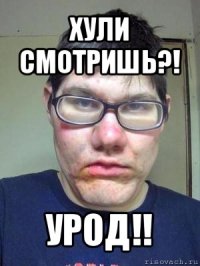 хули смотришь?! урод!!