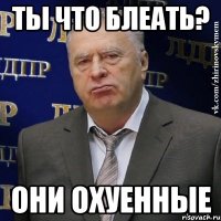 ты что блеать? они охуенные