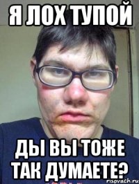 я лох тупой ды вы тоже так думаете?