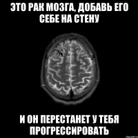 это рак мозга, добавь его себе на стену и он перестанет у тебя прогрессировать