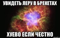 увидеть леру в брекетах хуево если честно