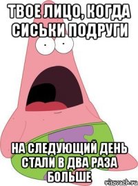 твое лицо, когда сиськи подруги на следующий день стали в два раза больше