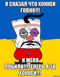 я сказал что хоккей говно!!! и меня побили!!!теперь я за хоккей!!!