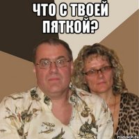 что с твоей пяткой? 