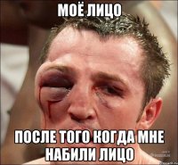моё лицо после того когда мне набили лицо