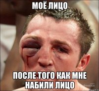 моё лицо после того как мне набили лицо