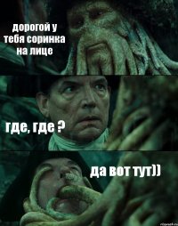 дорогой у тебя соринка на лице где, где ? да вот тут))