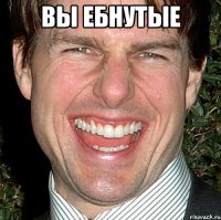 вы ебнутые 