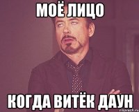 моё лицо когда витёк даун