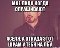 мое лицо когда спрашивают аселя, а откуда этот шрам у тебя на лбу