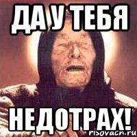 да у тебя недотрах!