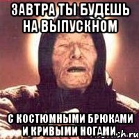 завтра ты будешь на выпускном с костюмными брюками и кривыми ногами.
