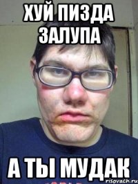 хуй пизда залупа а ты мудак