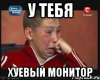 у тебя хуевый монитор