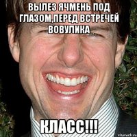 вылез ячмень под глазом,перед встречей вовулика класс!!!