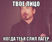 твое лицо когда тебя слил лагер