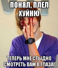 понял, плел хуйню теперь мне стыдно смотреть вам в глаза!