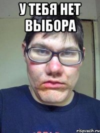 у тебя нет выбора 