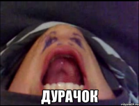 дурачок