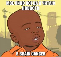 мое лицо когда я читаю новости в brain cancer