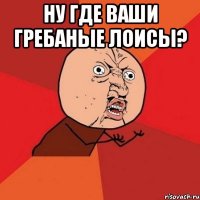 ну где ваши гребаные лоисы? 