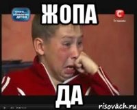 жопа да
