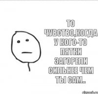 То чувство,когда у кого-то пятки загорели сильнее чем ты сам..