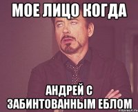 мое лицо когда андрей с забинтованным еблом