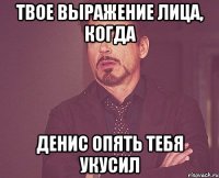 твое выражение лица, когда денис опять тебя укусил