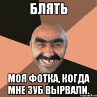 блять моя фотка, когда мне зуб вырвали.