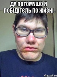 да потомушо я побідітєль по жизні 