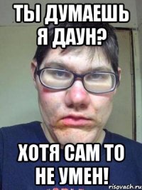 ты думаешь я даун? хотя сам то не умен!