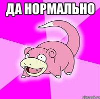 да нормально 
