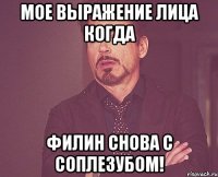 мое выражение лица когда филин снова с соплезубом!