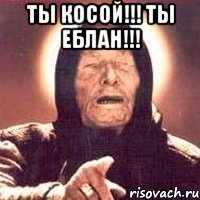 ты косой!!! ты еблан!!! 