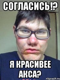 согласись!? я красивее акса?