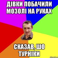 дівки побачили мозолі на руках сказав, шо турніки